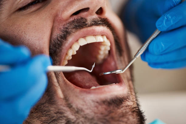 Best Urgent Tooth Repair  in New Albany, OH